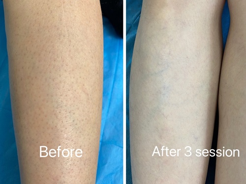 before after3.JPG