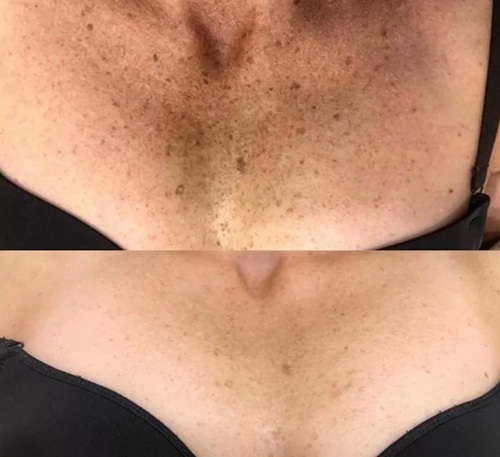 9 before after2.jpg
