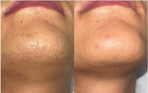 before after1.jpg