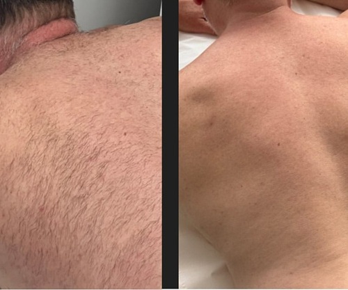 before after4.jpg
