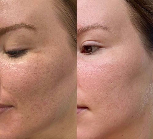 9before after3.jpg