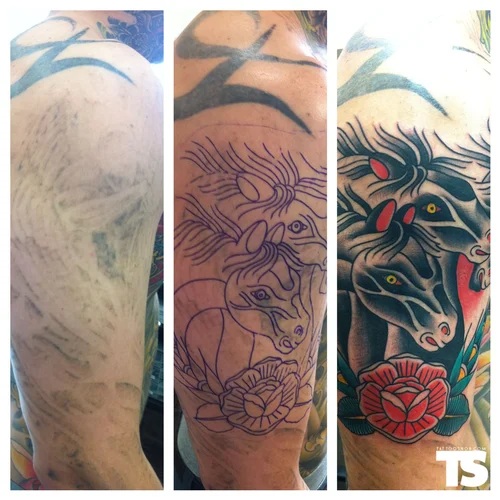 tattoo-removal-treatment-500x500.jpg