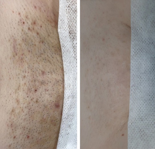before after2.jpg
