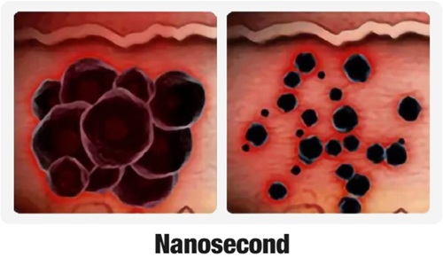 3 NanoSecond.jpg