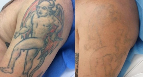 9 before after1.jpg