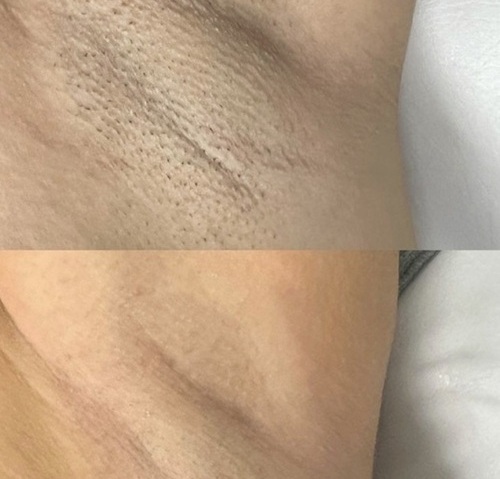before after1.jpg