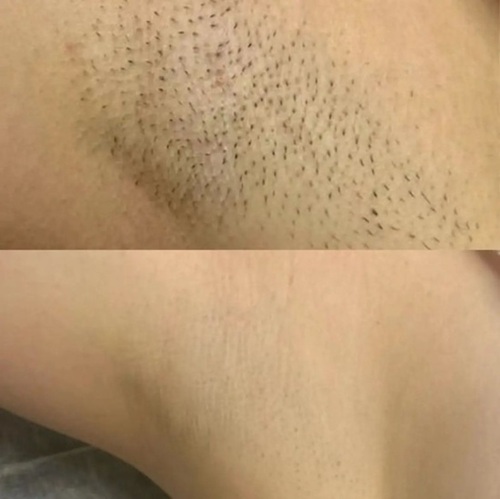 before after 1.jpg