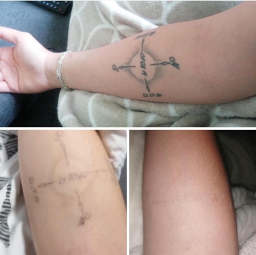 before after1.jpg