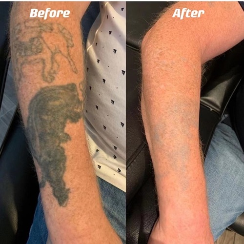 before after2.jpg