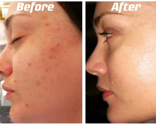 before after5.jpg