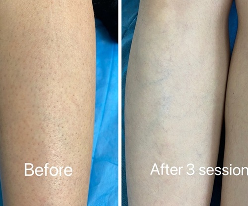 before after3.JPG