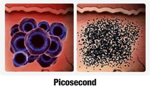 3 picosecond.jpg