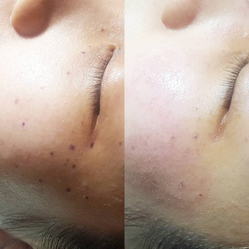 before after4.jpg