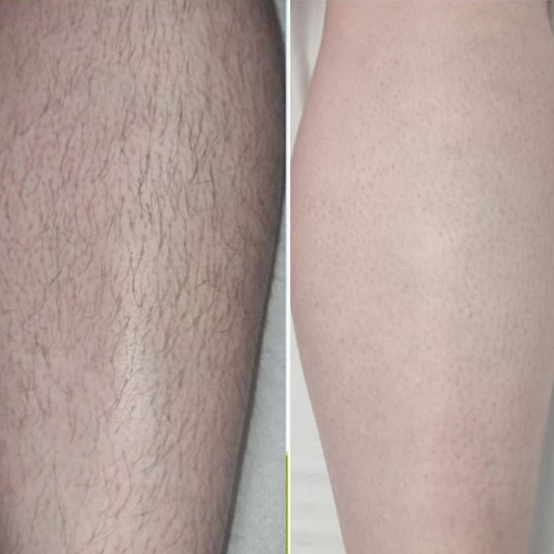before after3.jpg
