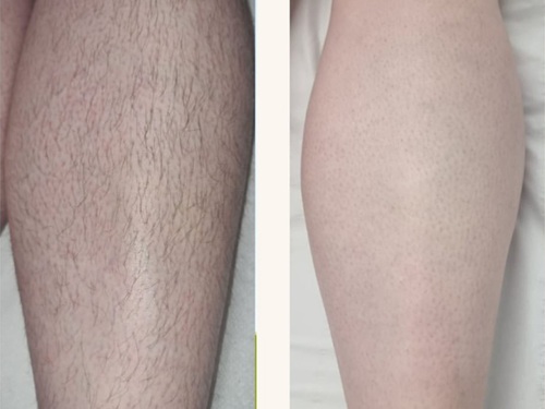before and after4.jpg