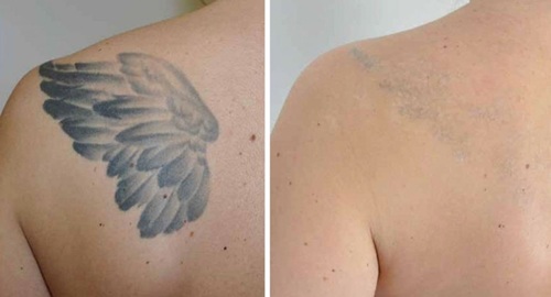 9 before after 4.jpg