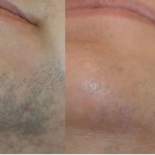 before after 5.jpg