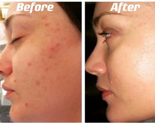 before after5.jpg