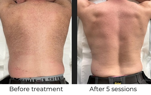 before after2.jpg