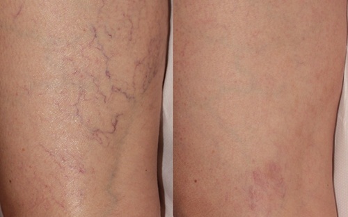 Before and after1.jpg