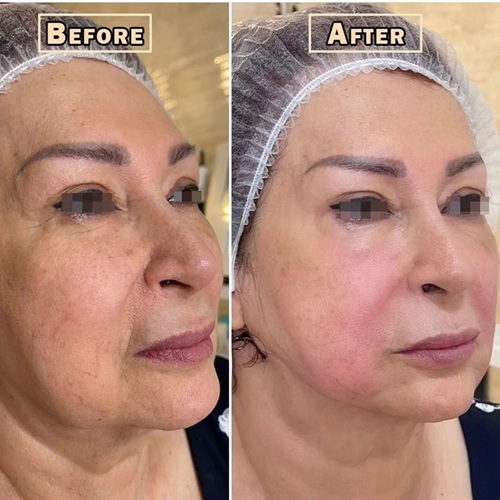 before after2.jpg
