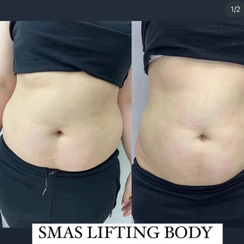before after3.jpg
