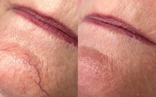 Before and after2.jpg