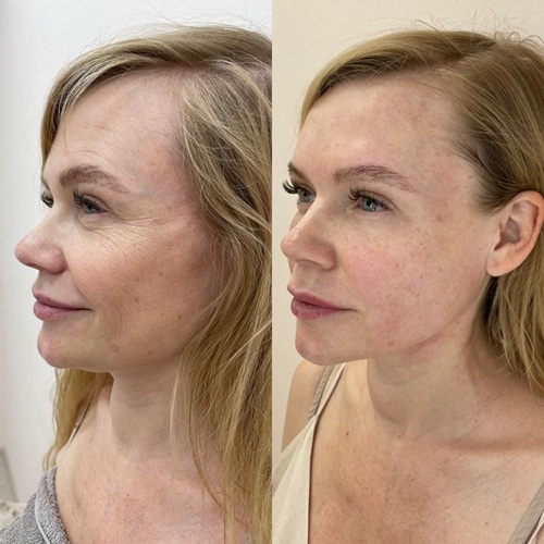 before after1.jpg